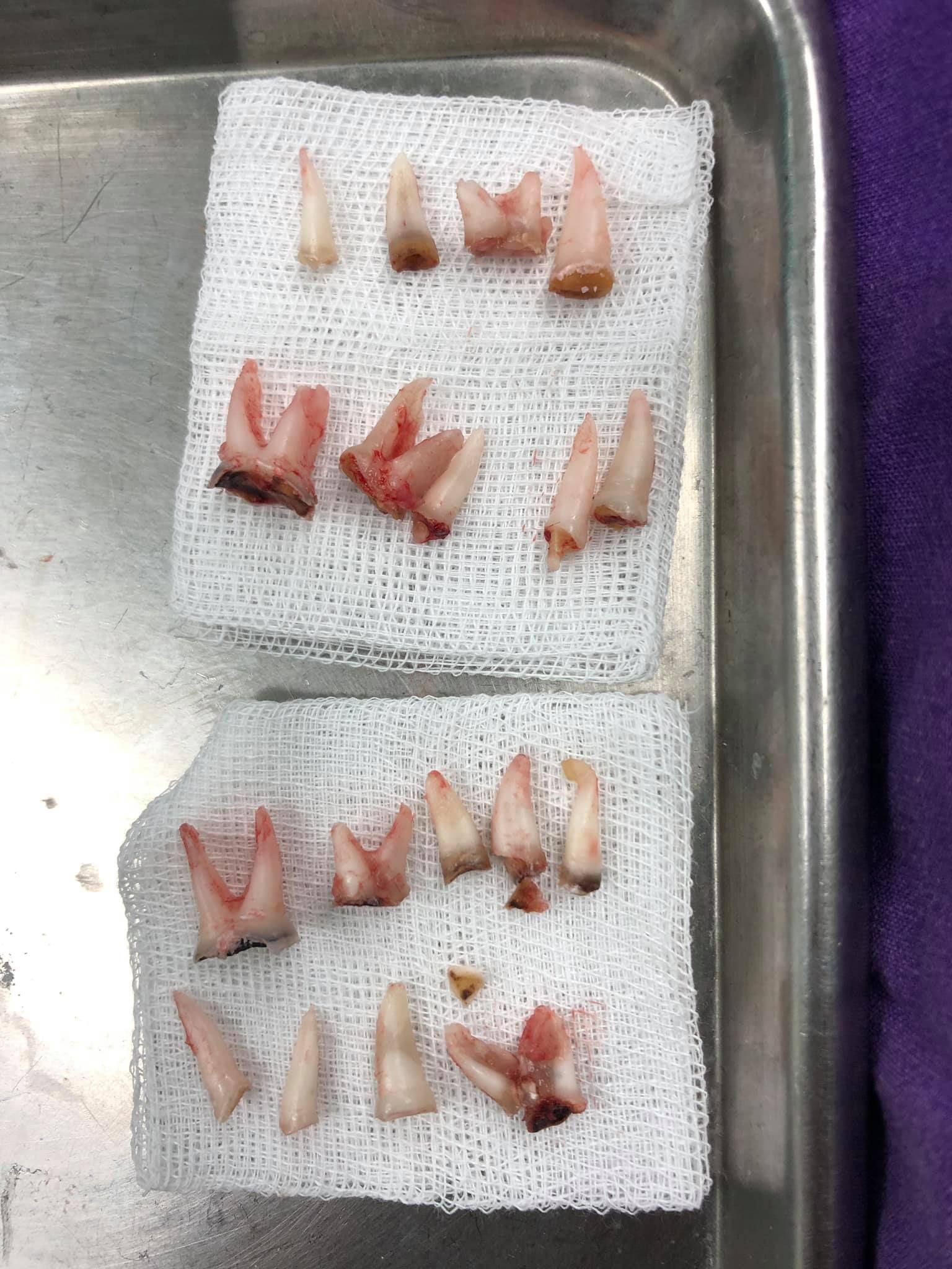 幼兒是蛀牙高危族 含奶樽瞓覺成爛牙主因_黃巴士